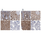 Immunohistochemical staining of human gastrointestinal, kidney, liver and placenta using Anti-DECR1 antibody HPA023238 (A) shows similar protein distribution across tissues to independent antibody HPA023160 (B).