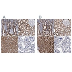 Immunohistochemical staining of human gastrointestinal, kidney, liver and placenta using Anti-DECR1 antibody HPA023238 (A) shows similar protein distribution across tissues to independent antibody HPA023160 (B).