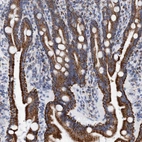 Immunohistochemical staining of human duodenum shows strong cytoplasmic granular positivity in glandular cells.