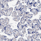 Immunohistochemical staining of human placenta shows no positivity in trophoblastic cells as expected.