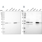 Western blot analysis using Anti-DECR1 antibody HPA023238 (A) shows similar pattern to independent antibody HPA023162 (B).