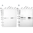 Western blot analysis using Anti-DECR1 antibody HPA023238 (A) shows similar pattern to independent antibody HPA023162 (B).