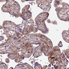 Immunohistochemical staining of human placenta shows moderate cytoplasmic positivity in trophoblastic cells.
