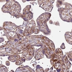 Immunohistochemical staining of human placenta shows moderate cytoplasmic positivity in trophoblastic cells.