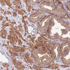 Immunohistochemical staining of human prostate shows strong cytoplasmic positivity in smooth muscles and glandular cells.
