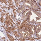 Immunohistochemical staining of human prostate shows strong cytoplasmic positivity in smooth muscles and glandular cells.
