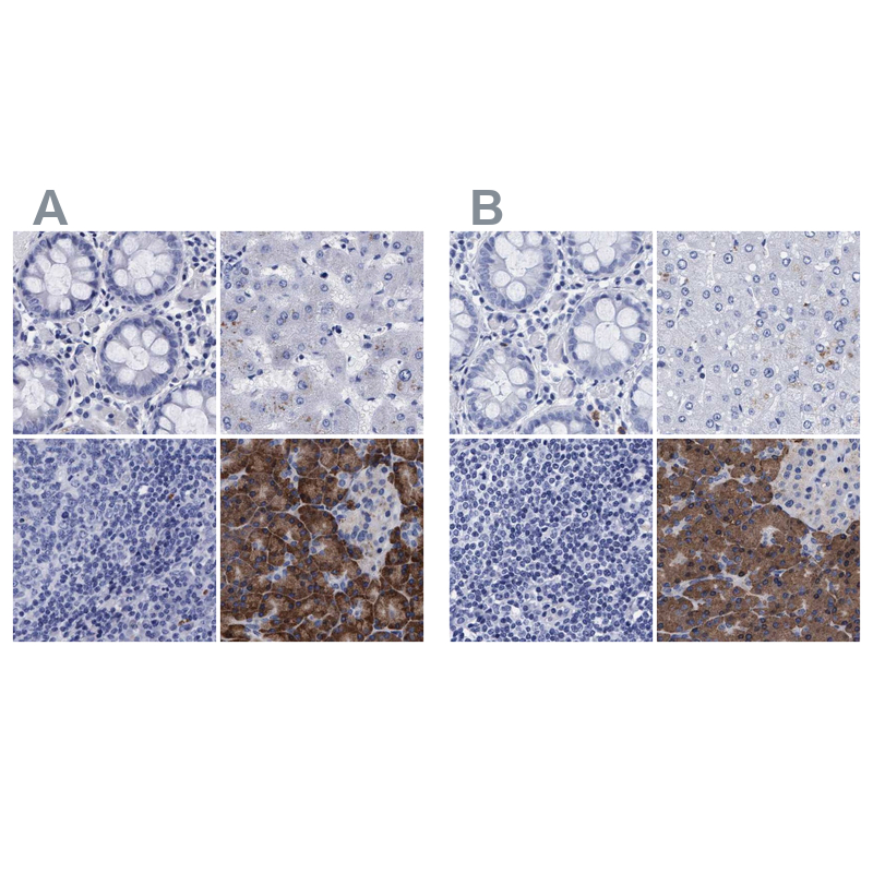 Anti-ARSG Antibody