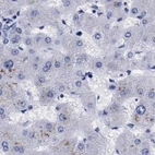 Immunohistochemical staining of human liver using Anti-ARSG antibody HPA023245.