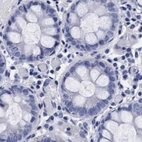 Immunohistochemical staining of human colon using Anti-ARSG antibody HPA023245.
