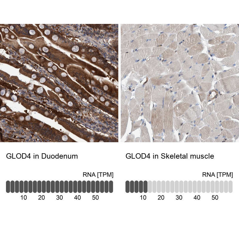 Anti-GLOD4 Antibody