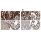 Immunohistochemical staining of human duodenum, kidney, skeletal muscle and testis using Anti-GLOD4 antibody HPA023246 (A) shows similar protein distribution across tissues to independent antibody HPA021623 (B).