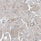 Immunohistochemical staining of human skeletal muscle shows low expression as expected.