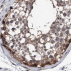 Immunohistochemical staining of human testis using Anti-GLOD4 antibody HPA023246.