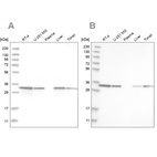 Western blot analysis using Anti-GLOD4 antibody HPA023246 (A) shows similar pattern to independent antibody HPA021623 (B).