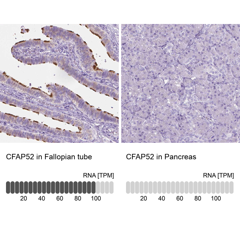 Anti-CFAP52 Antibody