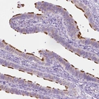 Immunohistochemical staining of human Fallopian tube shows strong positivity in cilia in glandular cells.