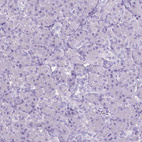 Anti-CFAP52 Antibody