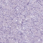 Immunohistochemical staining of human Pancreas shows no positivity in exocrine glandular cells as expected.