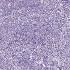 Immunohistochemical staining of human Tonsil shows no positivity in non-germinal center cells as expected.