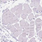 Immunohistochemical staining of human Skeletal muscle shows no positivity in myocytes as expected.