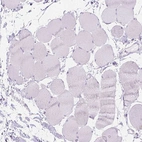 Immunohistochemical staining of human Skeletal muscle shows no positivity in myocytes as expected.