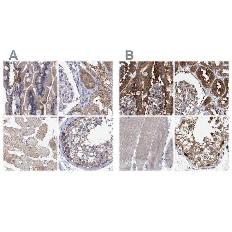 Anti-GLOD4 Antibody