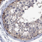 Immunohistochemical staining of human testis using Anti-GLOD4 antibody HPA023248.