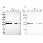 Western blot analysis using Anti-GLOD4 antibody HPA023248 (A) shows similar pattern to independent antibody HPA021623 (B).