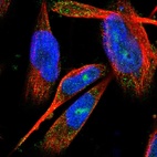 Immunofluorescent staining of human cell line U-251 MG shows localization to nucleus, nucleoli & cytosol.