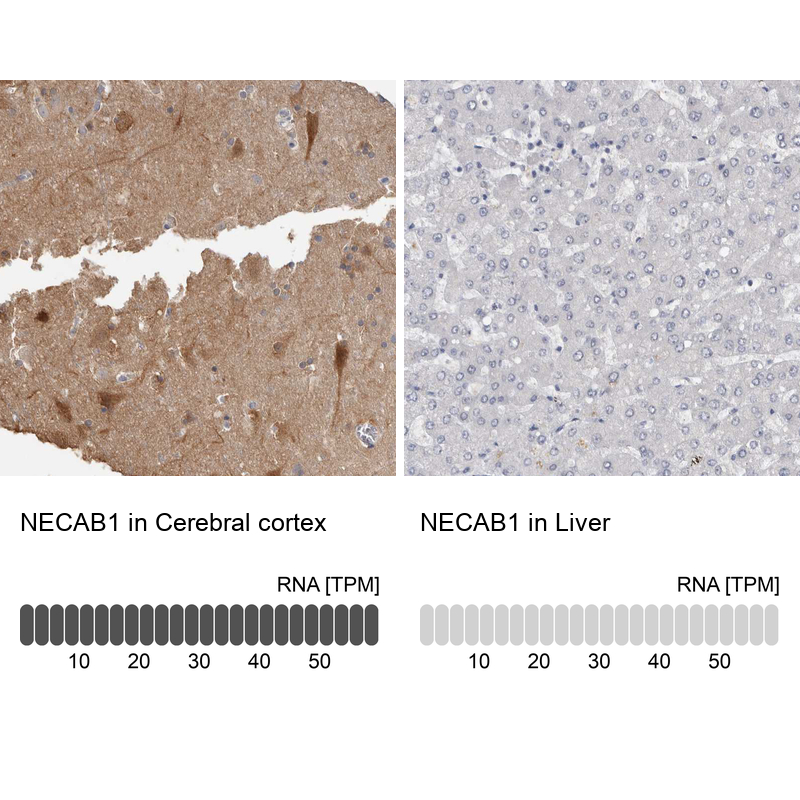 Anti-NECAB1 Antibody