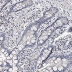 Immunohistochemical staining of human colon shows no positivity in glandular cells.