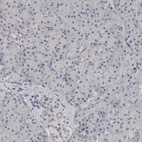 Immunohistochemical staining of human pancreas shows no positivity in exocrine glandular cells.