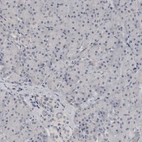 Immunohistochemical staining of human pancreas shows no positivity in exocrine glandular cells.
