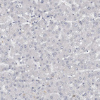 Anti-NECAB1 Antibody