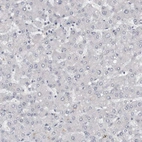 Immunohistochemical staining of human liver shows no positivity in hepatocytes.