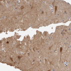 Immunohistochemical staining of human cerebral cortex shows strong cytoplasmic positivity in neurons.