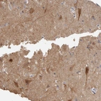 Immunohistochemical staining of human cerebral cortex shows strong cytoplasmic positivity in neurons.
