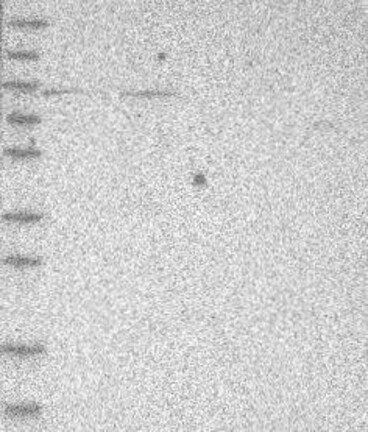 Anti-PHF21A Antibody