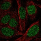 Immunofluorescent staining of human cell line U-2 OS shows localization to nucleoplasm.
