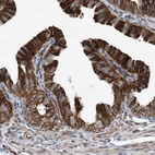 Immunohistochemical staining of human Fallopian tube shows moderate to strong membranous positivity in glandular cells.