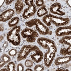 Immunohistochemical staining of human kidney shows strong cytoplasmic positivity in cells in tubules.