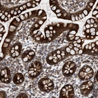 Immunohistochemical staining of human small intestine shows strong membranous and cytoplasmic positivity in glandular cells.