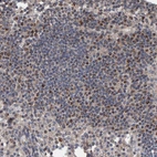 Immunohistochemical staining of human Lymph node shows strong granular cytoplasmic positivity in non-germinal center cells.