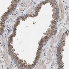 Immunohistochemical staining of human Prostate shows strong granular cytoplasmic positivity in glandular cells.