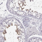 Immunohistochemical staining of human testis shows high expression.
