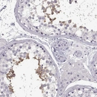 Immunohistochemical staining of human testis shows high expression.