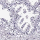 Immunohistochemical staining of human prostate shows low expression as expected.