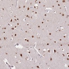 Anti-RFK Antibody