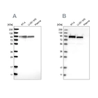 Western blot analysis using Anti-FAM129B antibody HPA023261 (A) shows similar pattern to independent antibody HPA021417 (B).