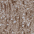 Immunohistochemical staining of human cerebral cortex shows strong positivity in neuronal processes.